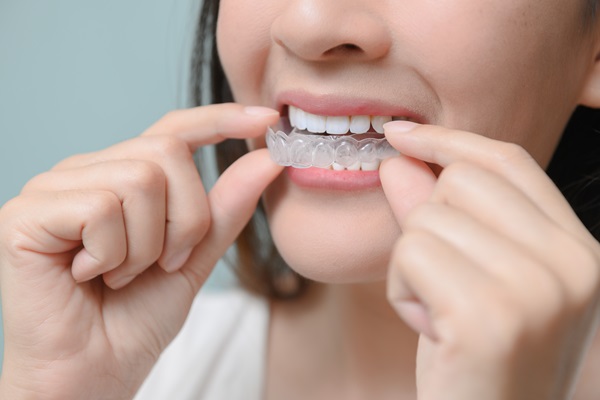 FAQs About Clear Aligners