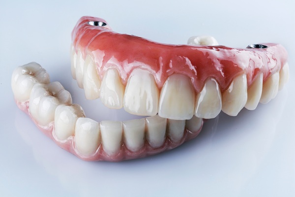 Implant Supported Dentures Can Solve The Problem Of Missing Teeth